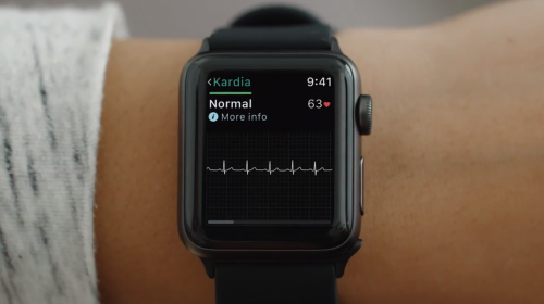 В конце прошлого года в версии watchOS 5.1.2 Apple Watch получили обновление с приложением для записи ЭКГ